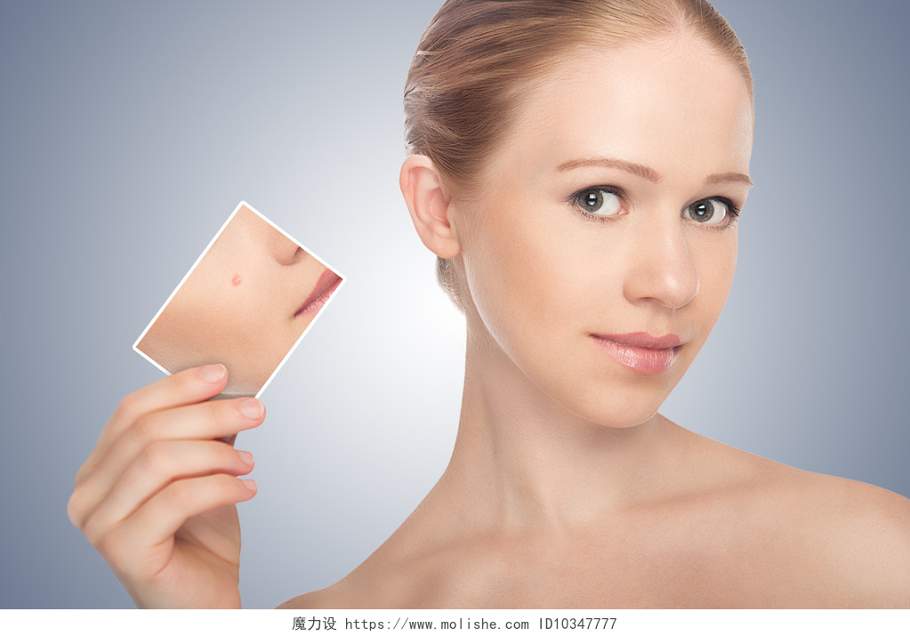 灰色背景一个女生展示自己的皮肤护肤的概念。皮肤的美容年轻女人之前和之后 t